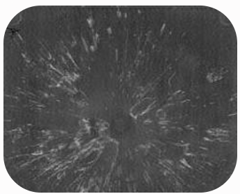 Defectos  de inyección 8: Ráfagas (Silver streaks)